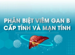 Viêm Gan B Cấp Tính và Mãn Tính là gì? Nguyên nhân và cách phòng tránh